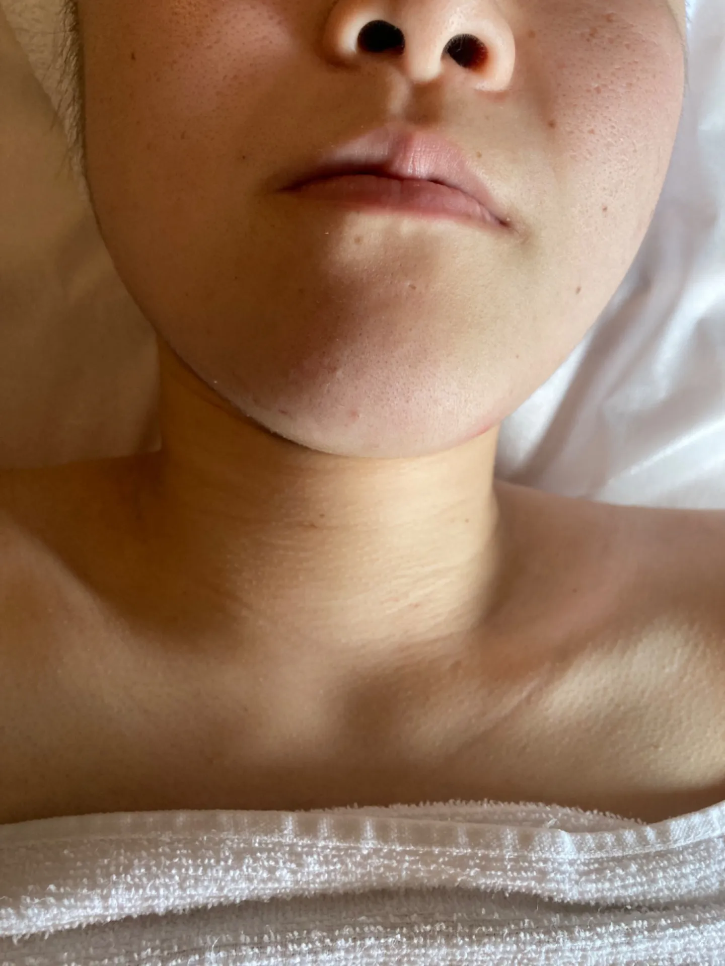 ある日のフェイシャルのお客様!別人級!!